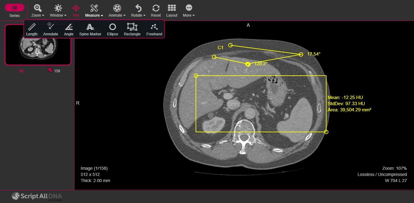 Using tools to view, modify an image of the brain with a DICOM Viewer